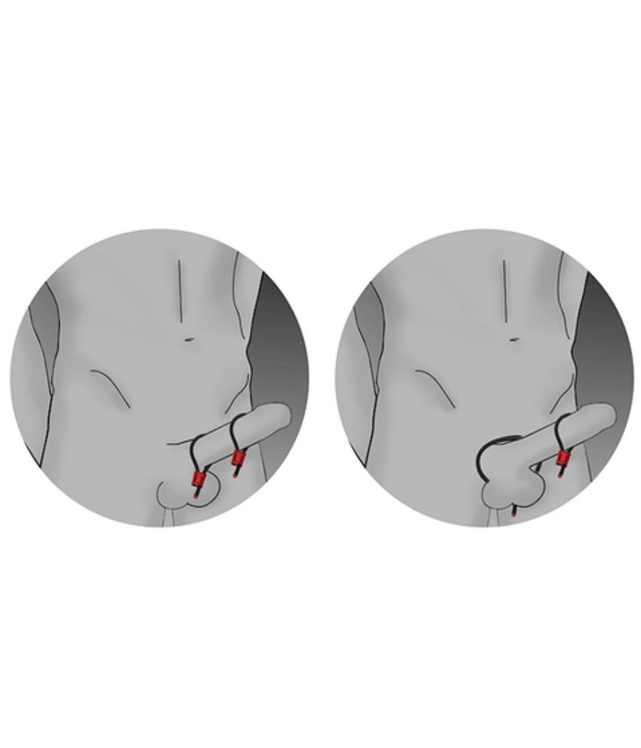 ELECTRASTIM - PRESTIGE ELECTRA LOOPS ANNEAUX PÉNIENS RÉGLABLES ROUGES