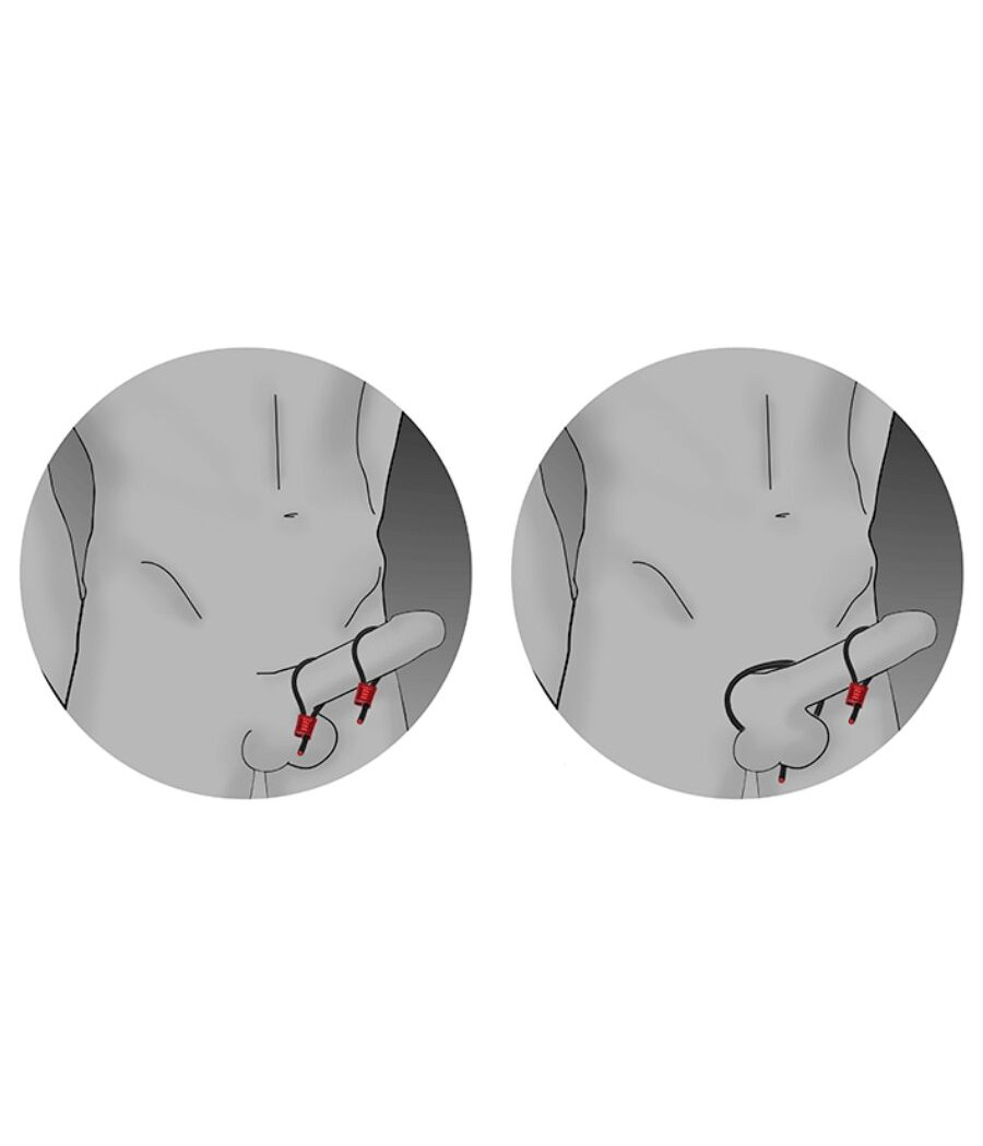 ELECTRASTIM - PRESTIGE ELECTRA LOOPS VERSTELLBARE COCKRINGE SCHWARZ